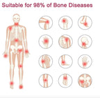 Perfectx Joint and Bone Treatment Cream (Buy 1 Get 1 Free)